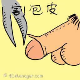 割包皮 circumcision