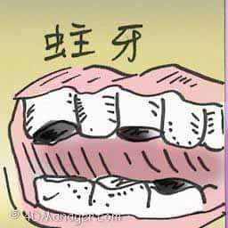 蛀牙 decayed tooth