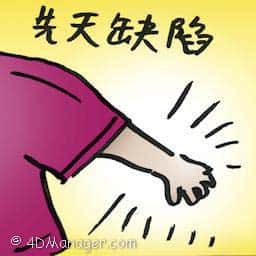 先天缺陷 birth defect