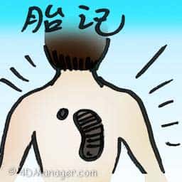 胎记 birthmark