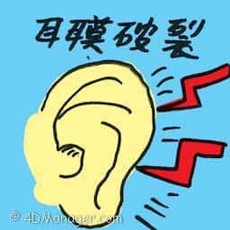 耳膜破裂 ruptured eardrum
