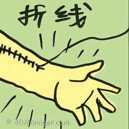 拆线 take out stitches