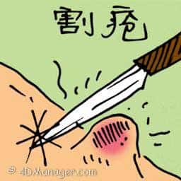 割疮 removing sore