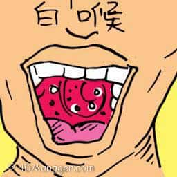 白喉 diphtheria (serious nose and throat infection)