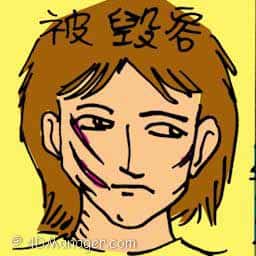 被毁容 disfigured face