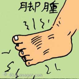 脚肿 swollen leg