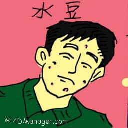 水痘 chicken pox