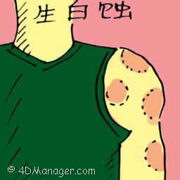 生白蚀 skin disease