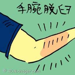 手腕脱臼 dislocated wrist