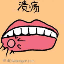 溃疡 lip ulcer