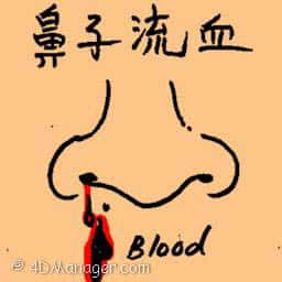 鼻子流血 nose bleeding