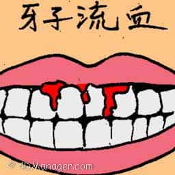 牙齿流血 tooth bleeding