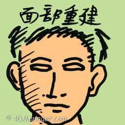 面部重建 facial reconstruction