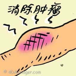 消除肿瘤 removing tumor