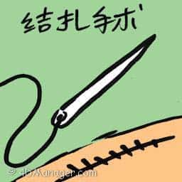 结扎手术 ligation