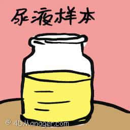 尿液样本 urine sample