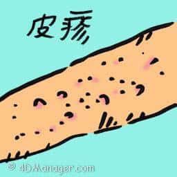 皮疹 skin rashes