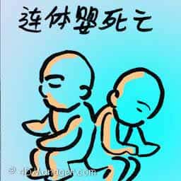 连体婴死亡 conjoined twins death
