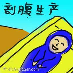 剖腹生产 caesarean section