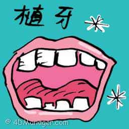 植牙 dental implant